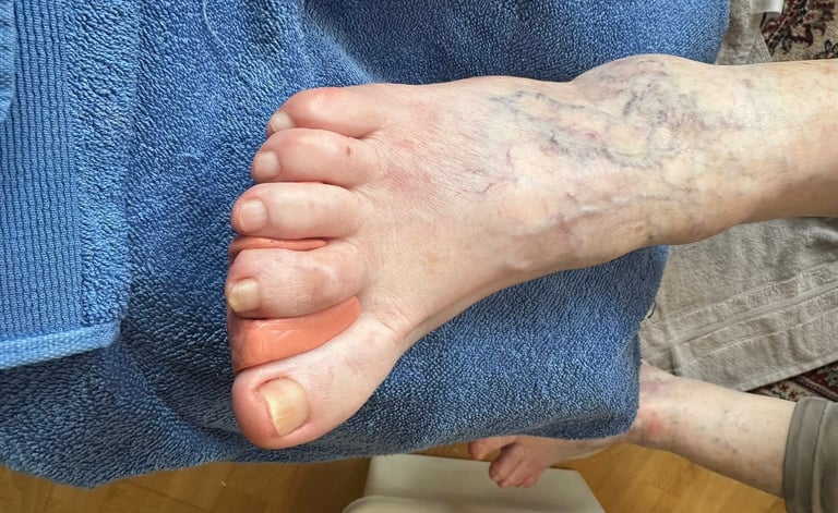 Adult hand gently holding infant's small foot against blue fabric